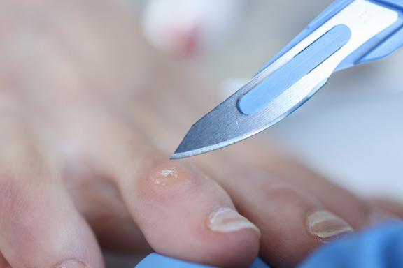 soins des pieds soins des pieds