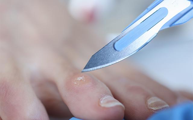 Soins des pieds